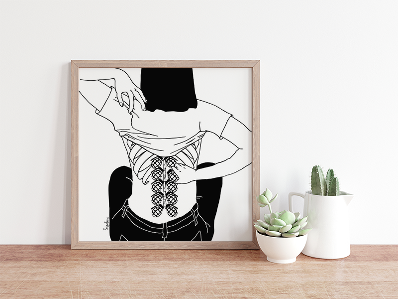 תמונה ממוזערת: השדרה נפיצה