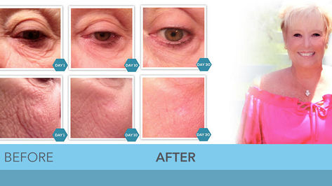 With RxGenesys You Can Expect Results