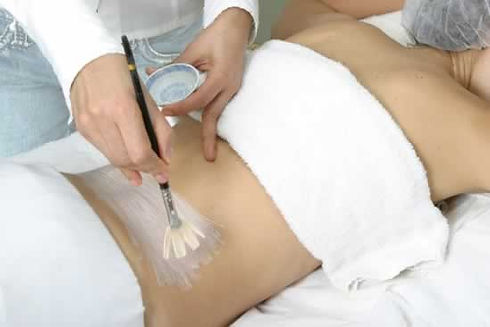 Peeling Químico Corporal