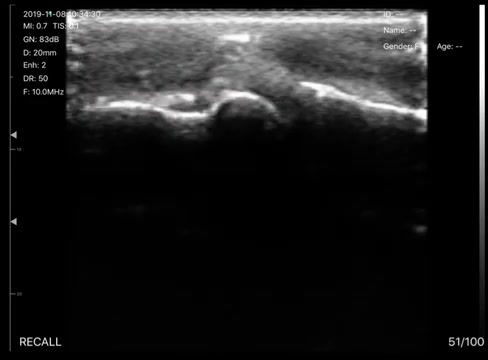 Thumbnail: SONOQUE L5N - Wireless Handheld Ultrasound Scanner