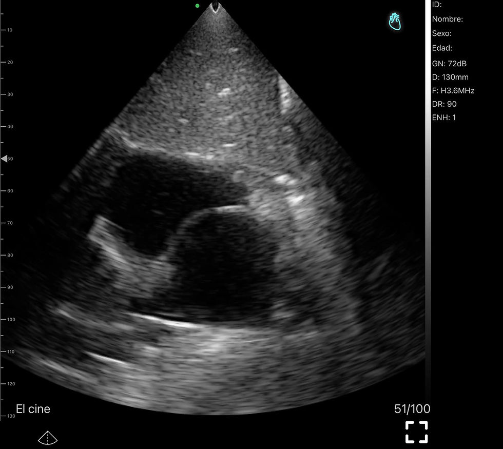Thumbnail: SONOQUE L4PC - Wireless Portable Ultrasound Probe