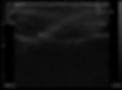 Thumbnail: SONOQUE L5PC - Wireless Handheld Portable Ultrasound