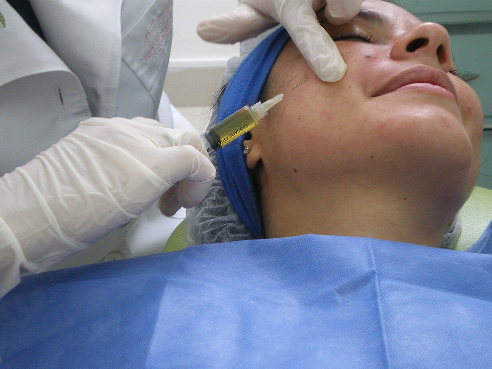 Plasma Rico en Plaquetas PRP