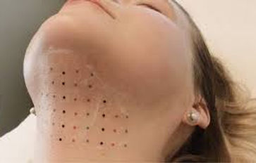Fat-Dissolving Injections-1.jpeg