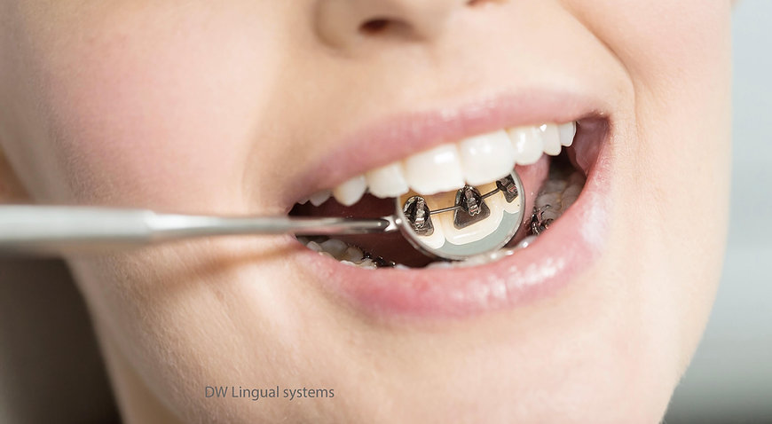 orthodontie annecy
