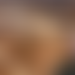 Kazdağları’nda Bir Milyon Ağaç Kesilecek mi?