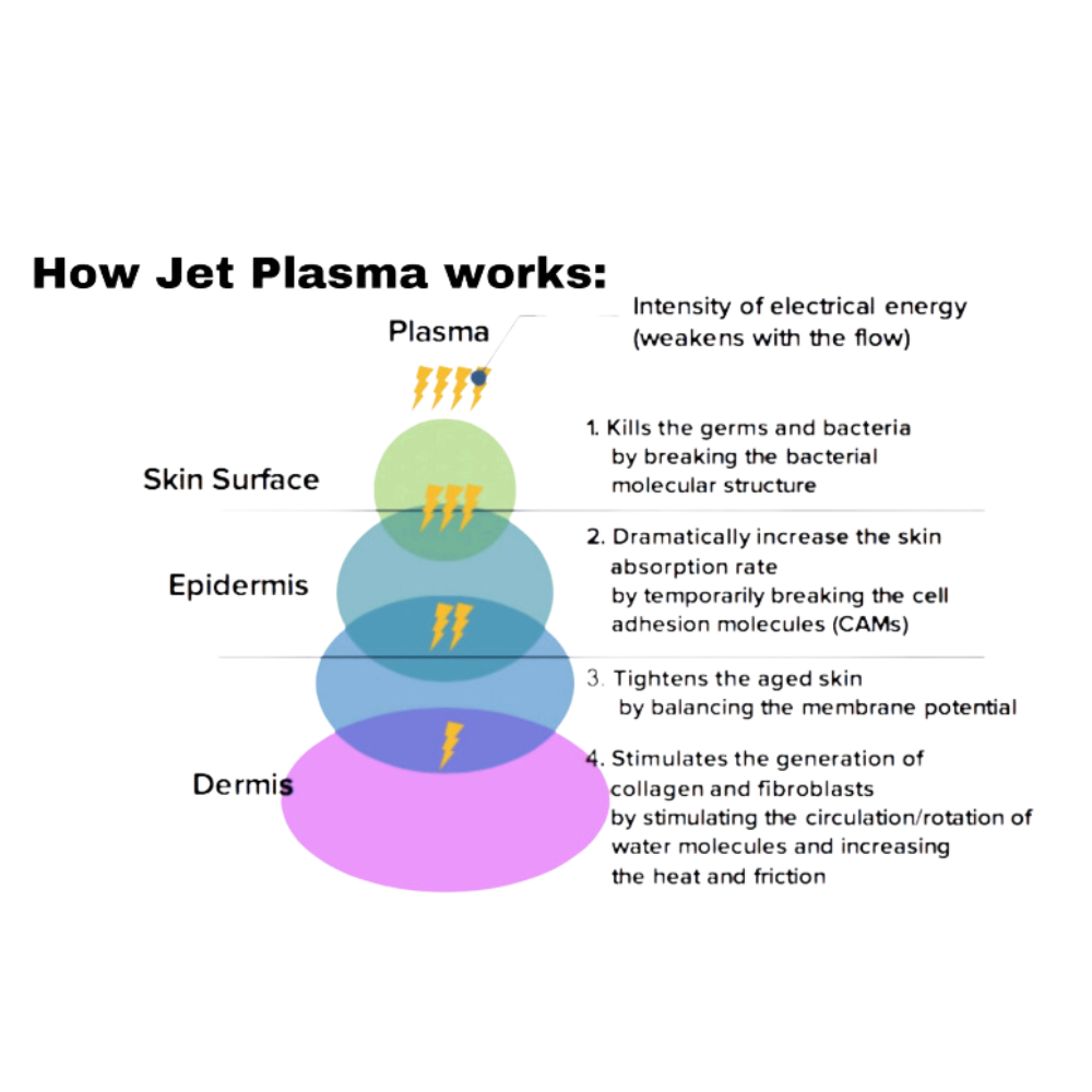 Jet Plasma infographic