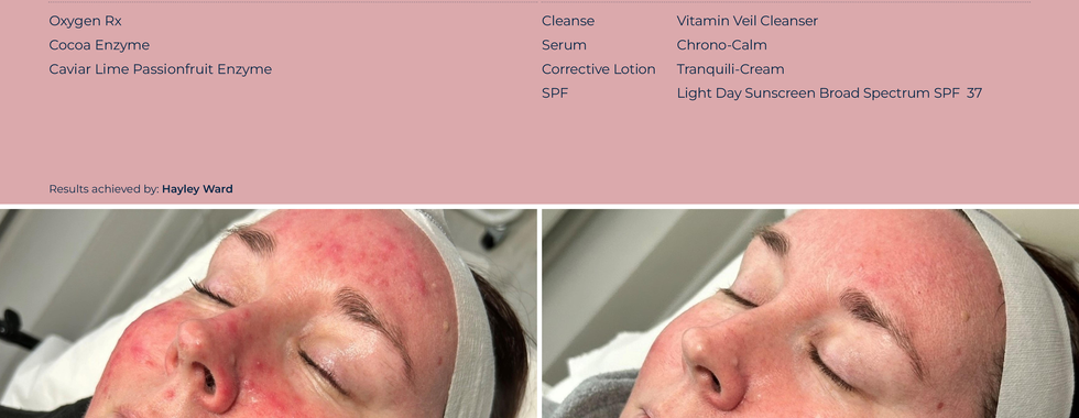 Circadia Skincare 10 week transformation
