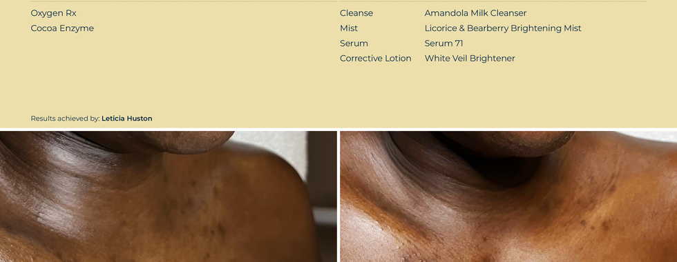 Circadia Skincare 10 week transformation