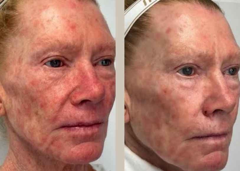 before and after photo