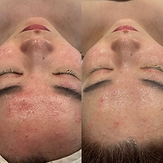 Before and after photos