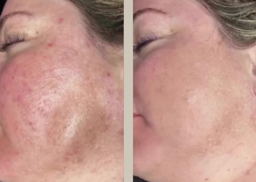 before and after photo