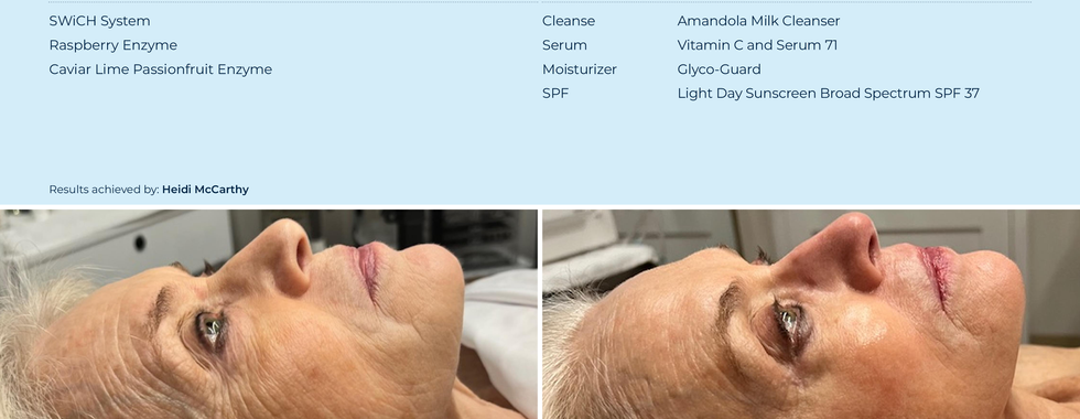 10 week transformation