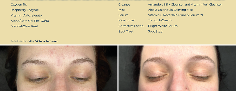 Circadia Skincare 10 week transformation
