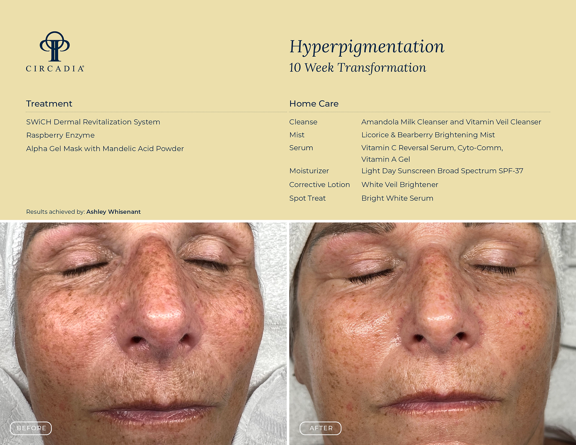 Circadia Skincare 10 week transformation