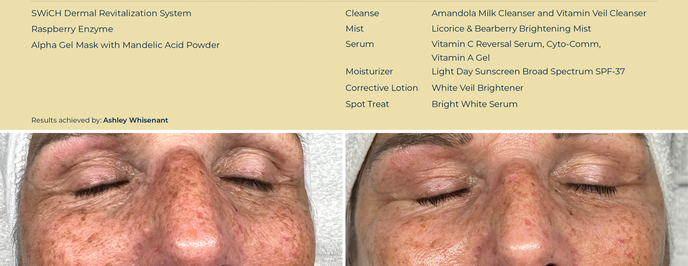 Circadia Skincare 10 week transformation