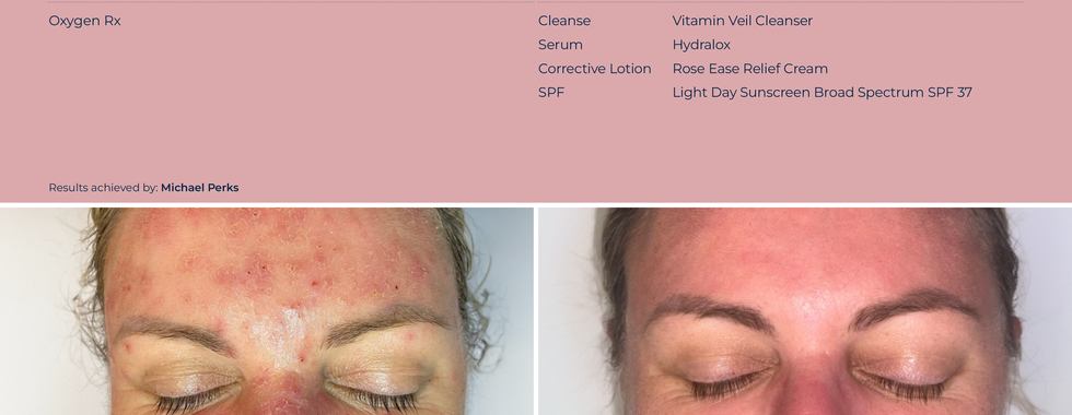 Circadia Skincare 10 week transformation