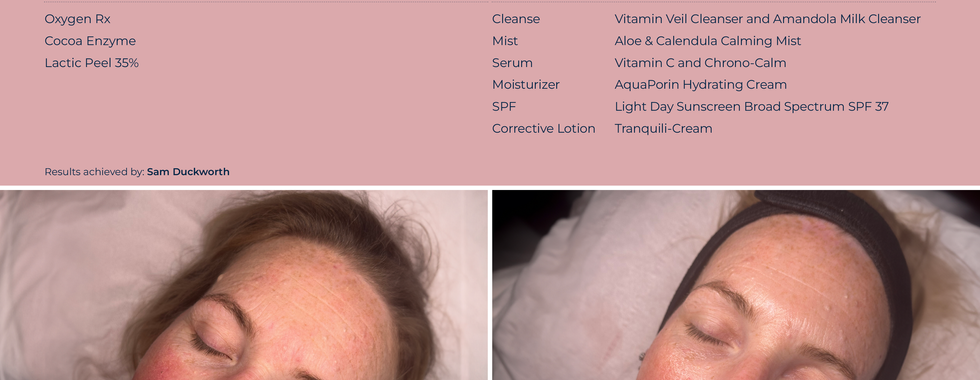 Circadia Skincare 10 week transformation