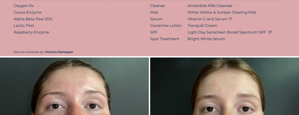 Circadia Skincare 10 week transformation