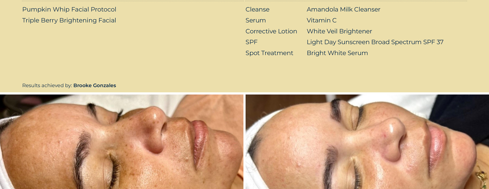 Circadia Skincare 10 week transformation