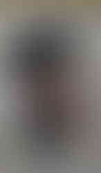 A dog with big ears looking at the camera