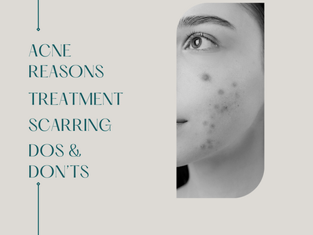 Acne: reasons, treatment, scarring, Dos & Don'ts
