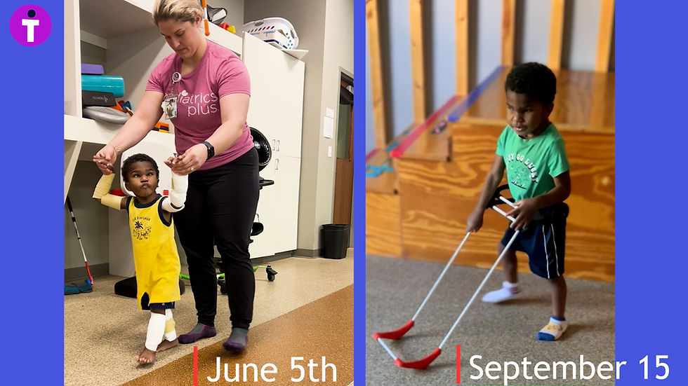 Side by side photos of the same 3-year-old child. Left he is walking with leg braces and arm braces, holding both his therapist’s hands to walk, she is behind him, and his arms are above his head. On the right, he is walking independently, no braces, just wearing his belt cane.