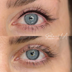 Top Lash Line