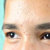 Nourishment and the Skin: The Face as a Mirror of Diet