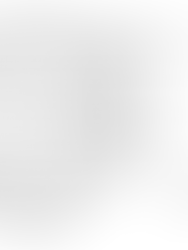 A Case Study on Cyclotron with Classical and Relativistic Perspectives