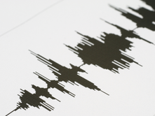 White noise: the science behind it and its connection to the brain