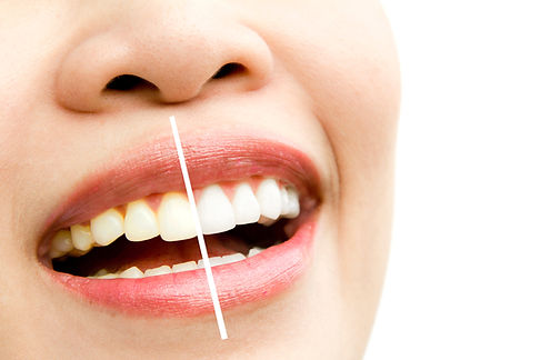 woman-whitening-treatment.jpg