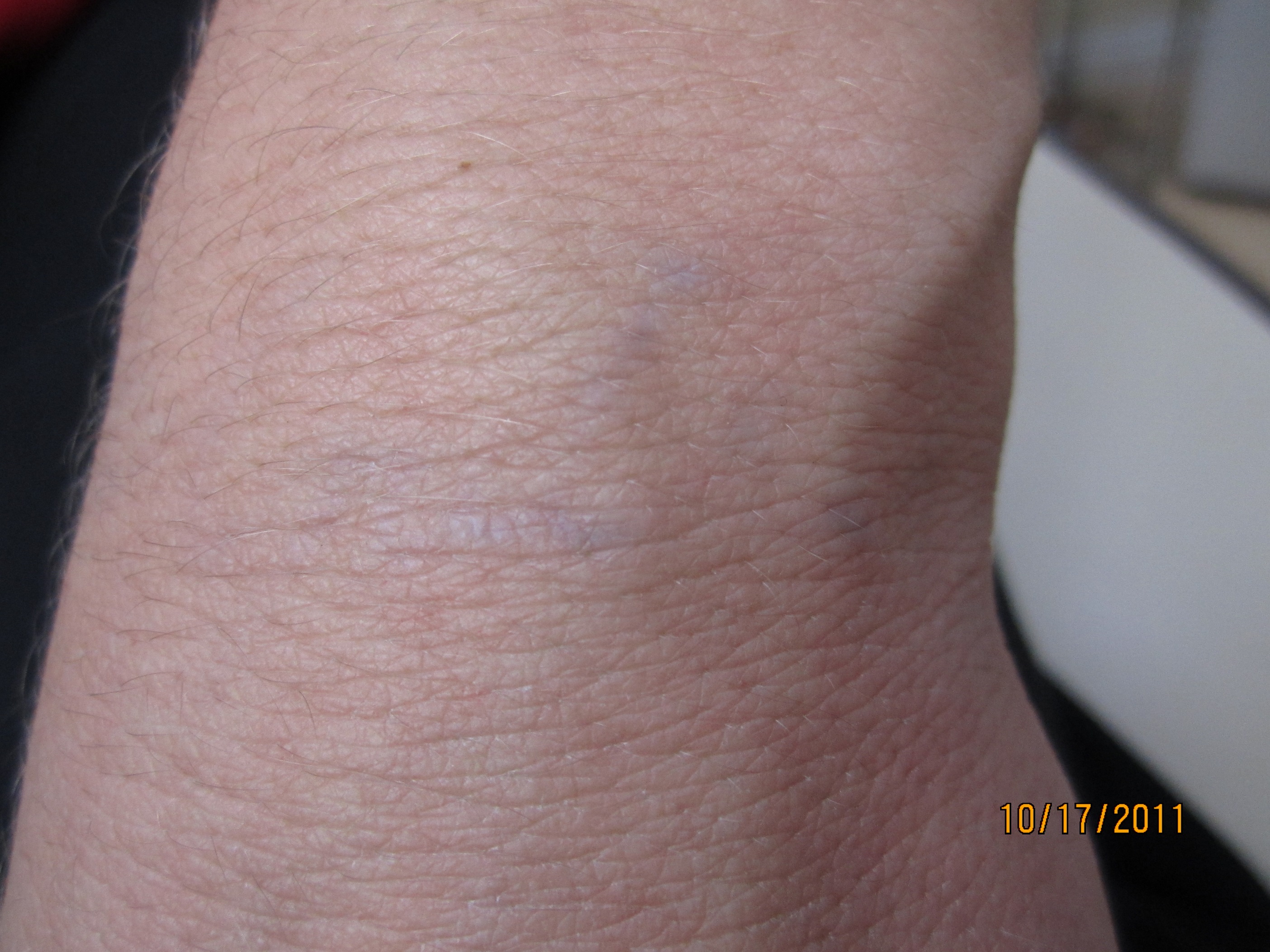 Top Of Wrist Script