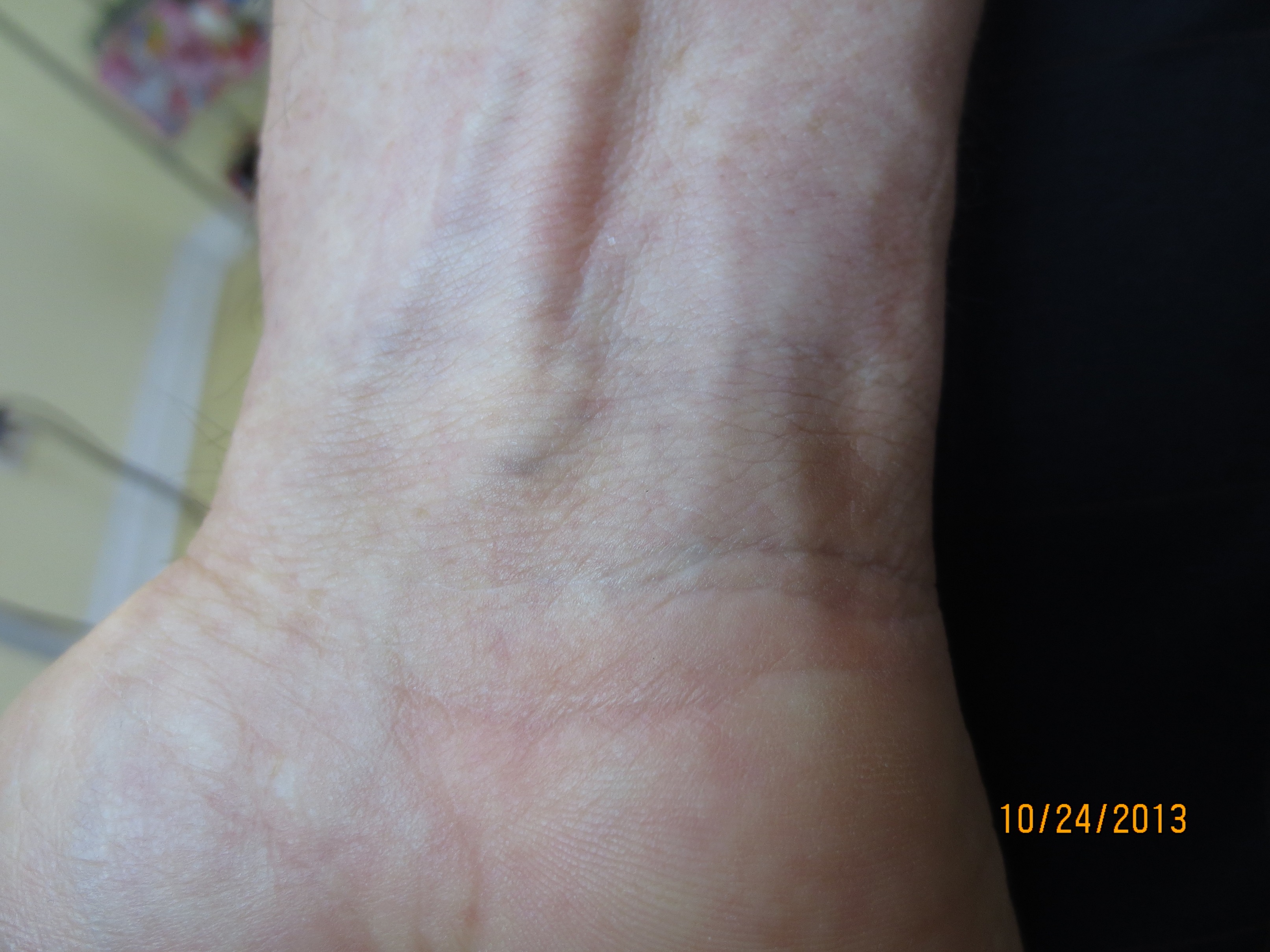 Inner Wrist