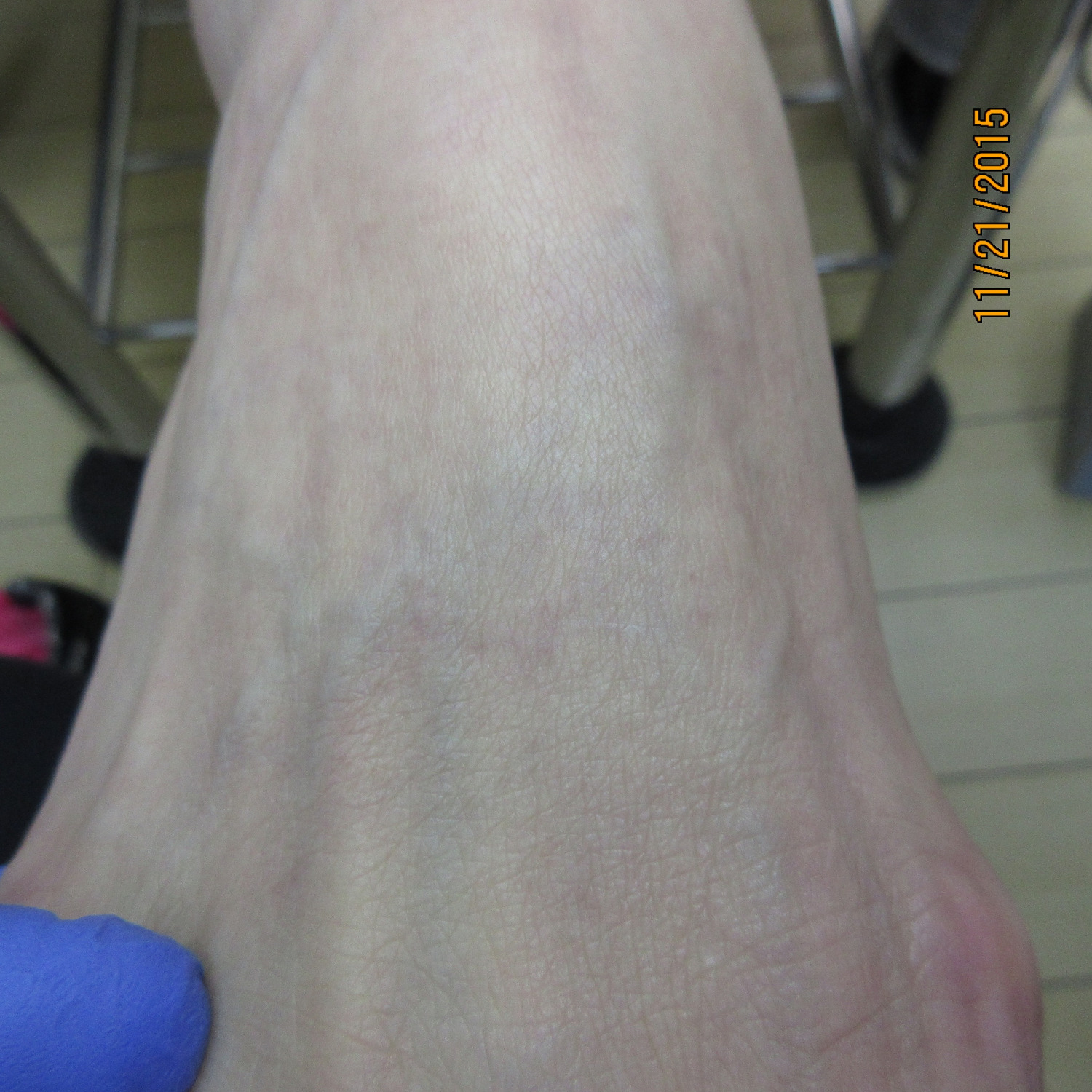 Top Of Foot.