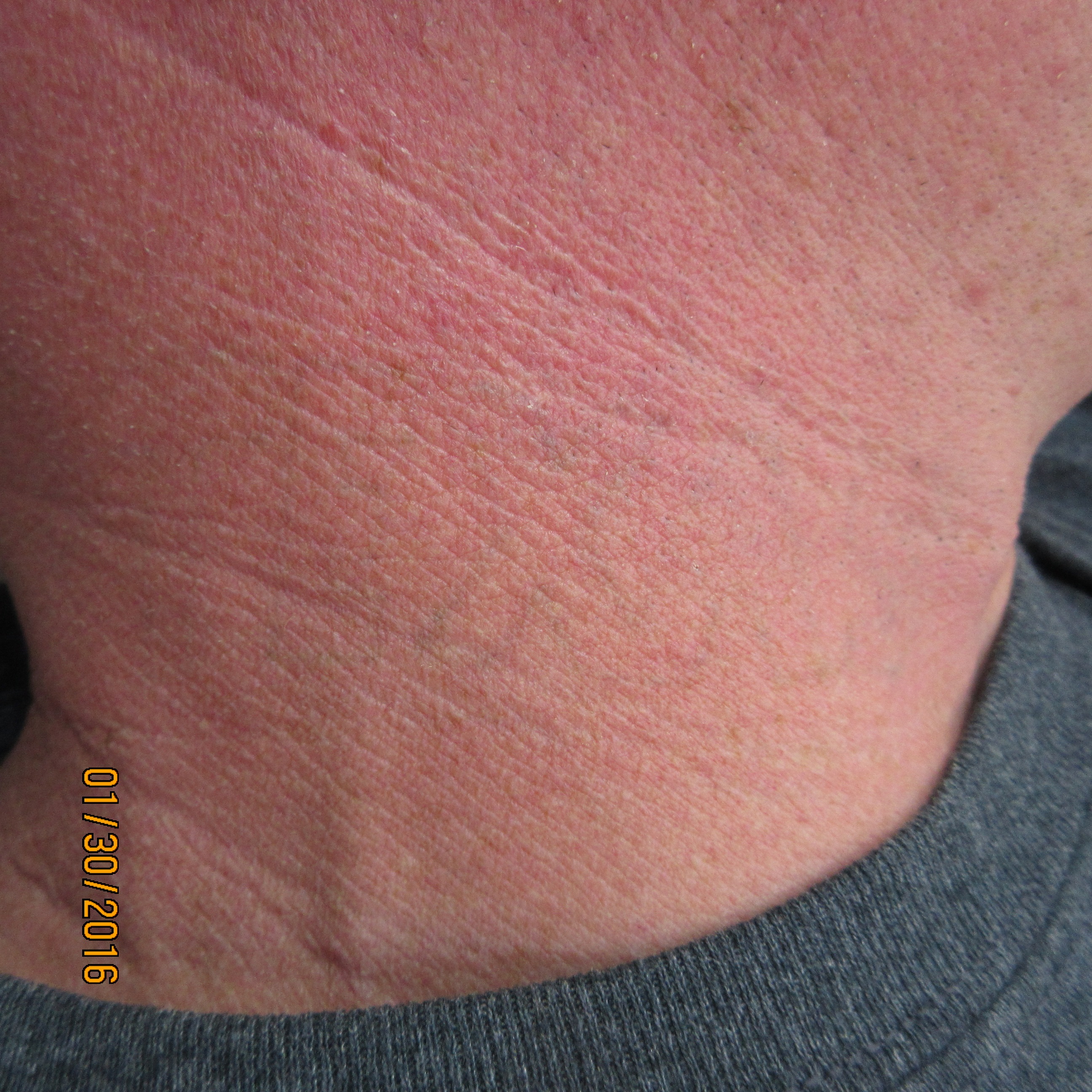 Neckline