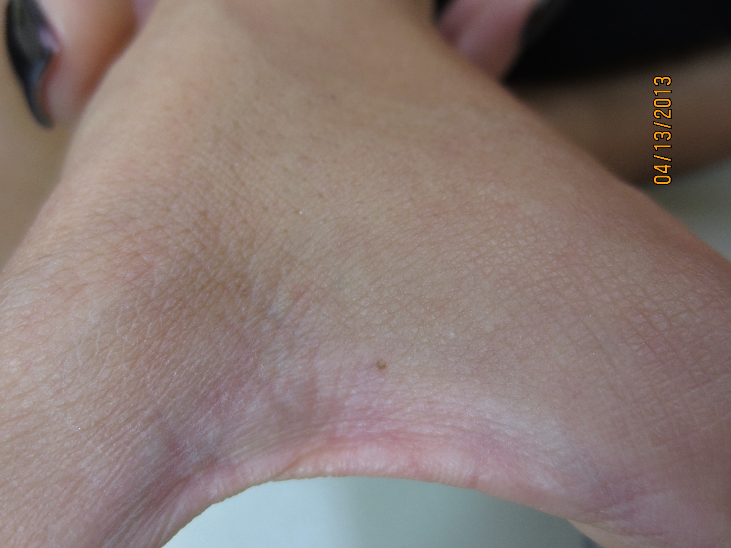 Top Of Hand