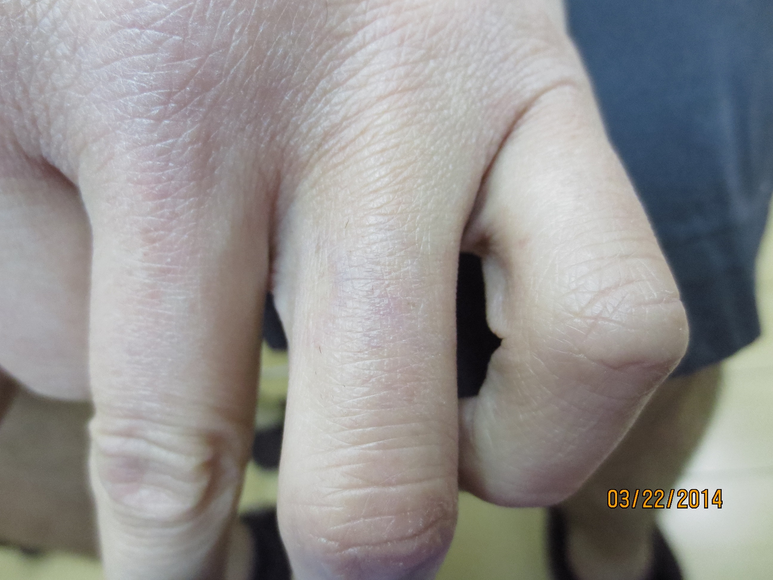 Ring Finger