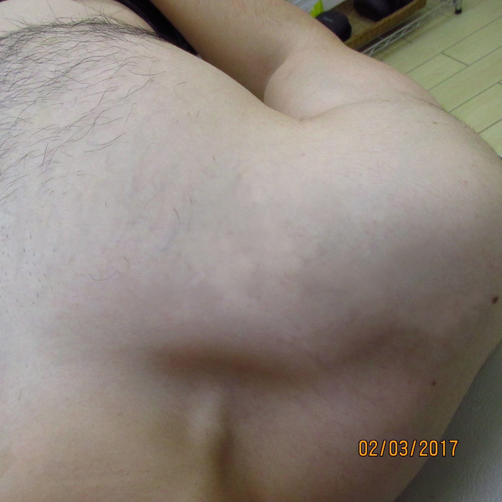 Full Chest Script Right