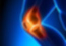 arthrite-et-polyarthrite-rhumatoide-tout-savoir-1.jpg