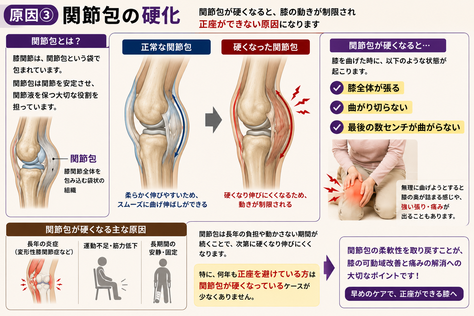 淀川区・塚本】正座ができない膝の痛みの原因とは？変形性膝関節症だけ