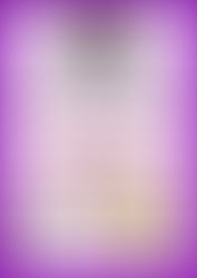 Vitiligo challenge on June24th, 2020