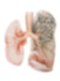 pathology lungs - maria socias.jpg