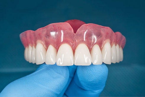Dentition de machoire supérieure
