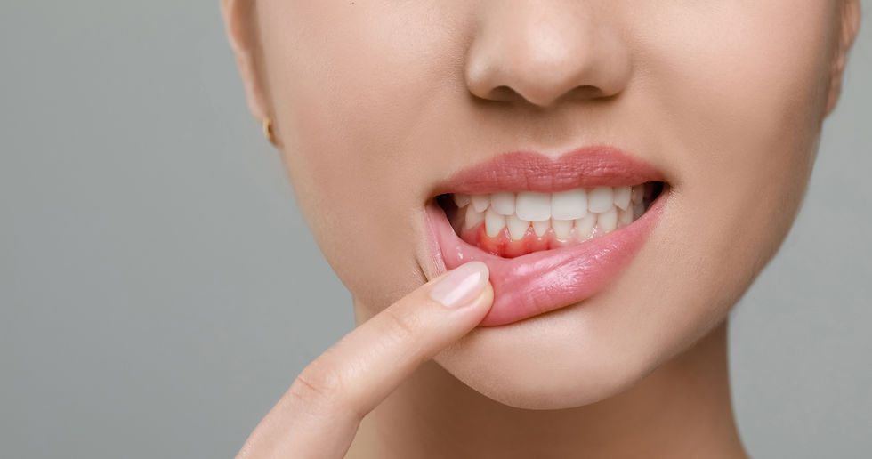 Woman showing inflamed gum