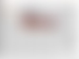 Waste management: An eye-opener!