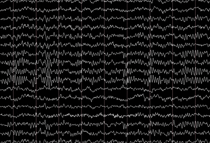 3d9ae7_85445032025b46bcad4b45815523e8c5~mv2.gif