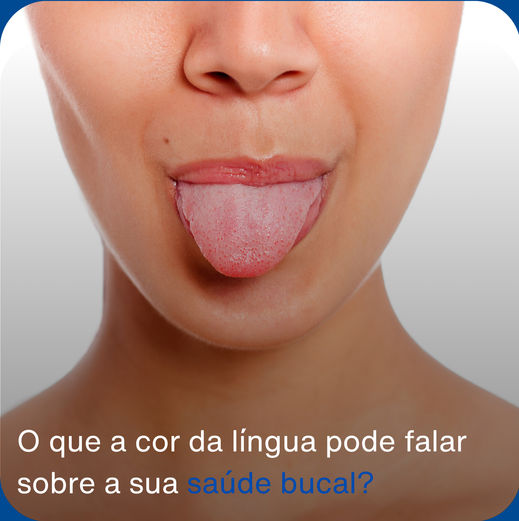 O que a cor da língua pode revelar sobre sua saúde bucal