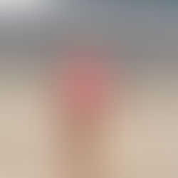 5/6/25- Shoulder Smoke