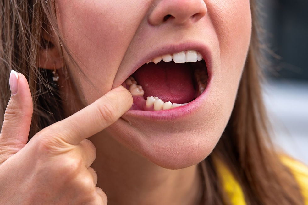 Wisdom Tooth Extraction in Old Bridge, NJ - Bond Dental Studios
